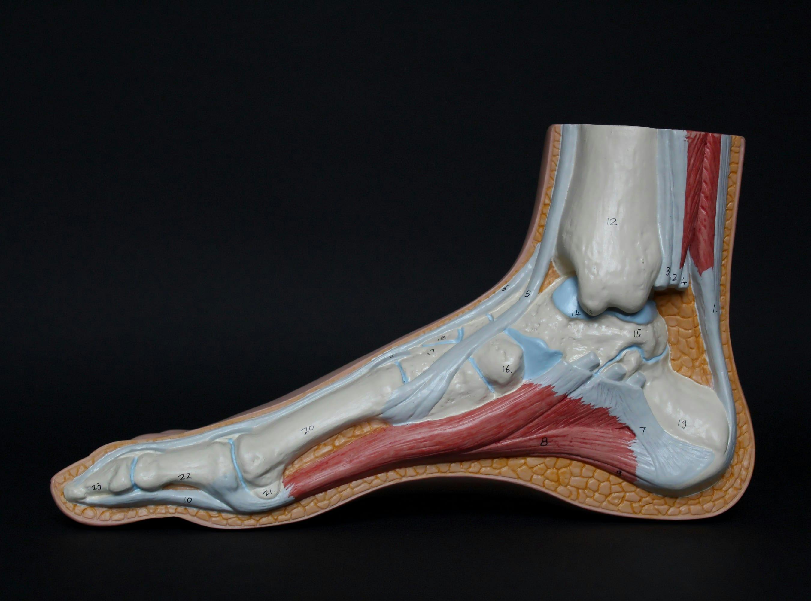 Foot Drop: How to Know if You Have a Case