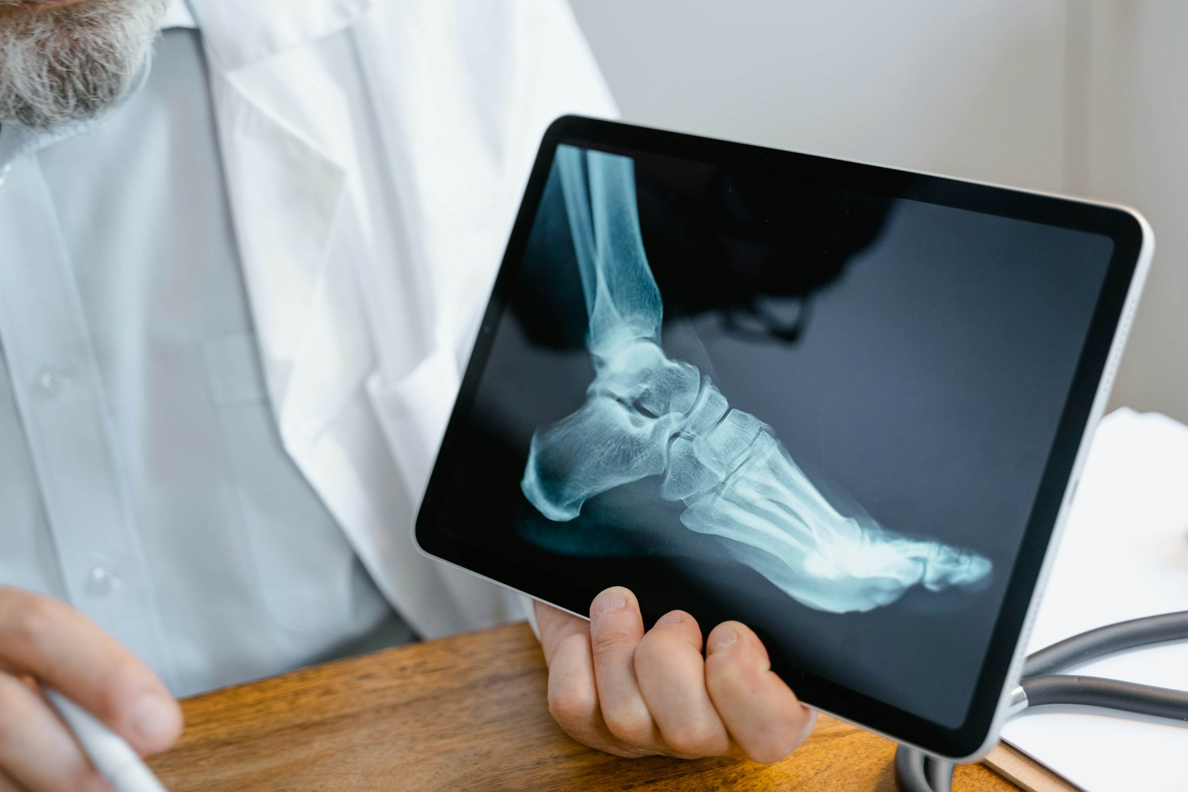 Foot x-ray displayed on tablet