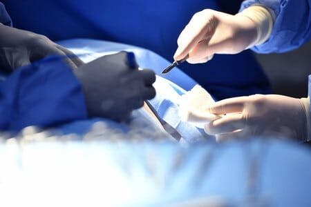Patient Develops Diaphragm Paralysis Following Cardiothoracic Surgery