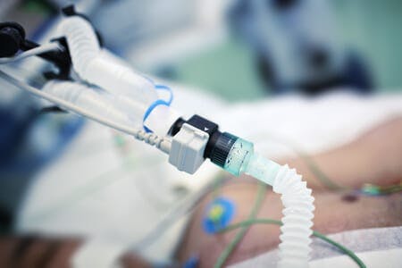 Anesthesiology Error Leaves Colonoscopy Patient On Ventilator