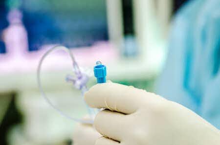 Misplaced Catheter Causes Significant Urological Damage