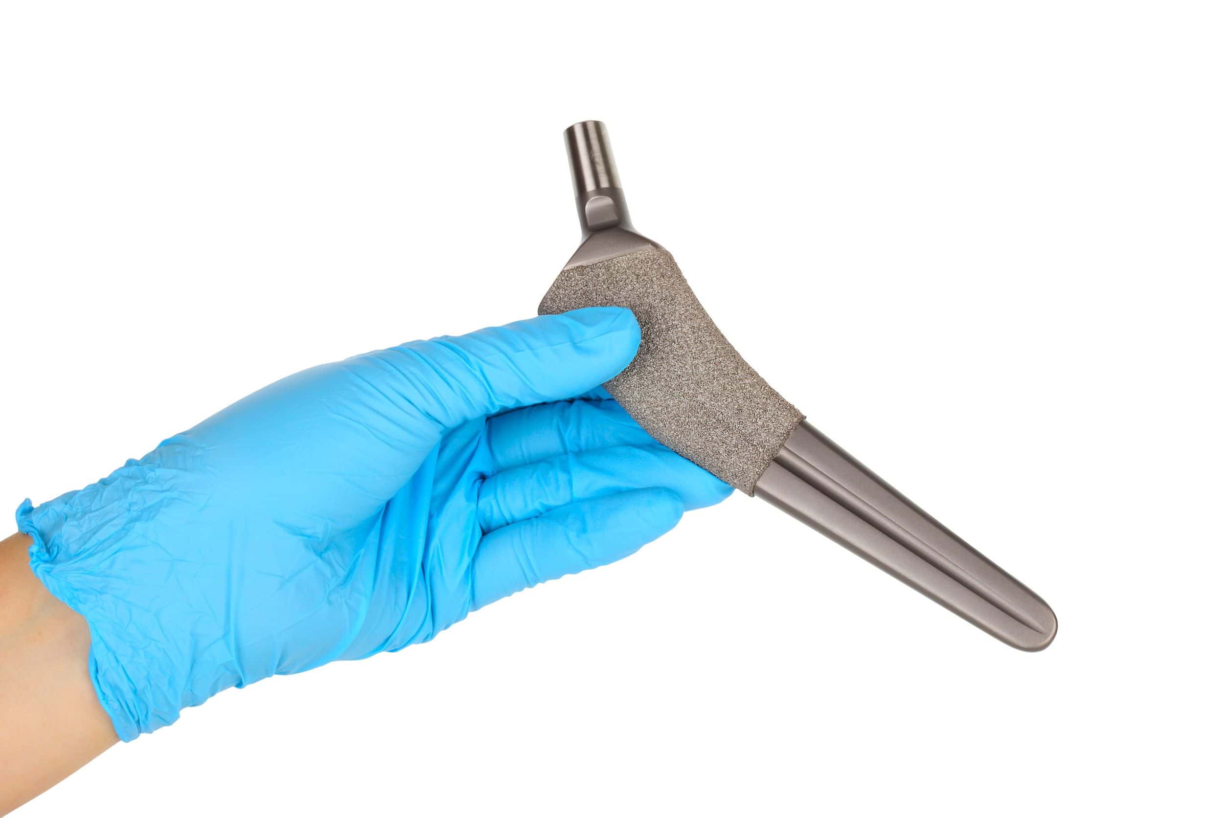 Woman Claims Hip Replacement Deposited Metals, Forced Revision Surgery