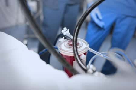 Patient Develops Compartment Syndrome Following Heart Valve Replacement