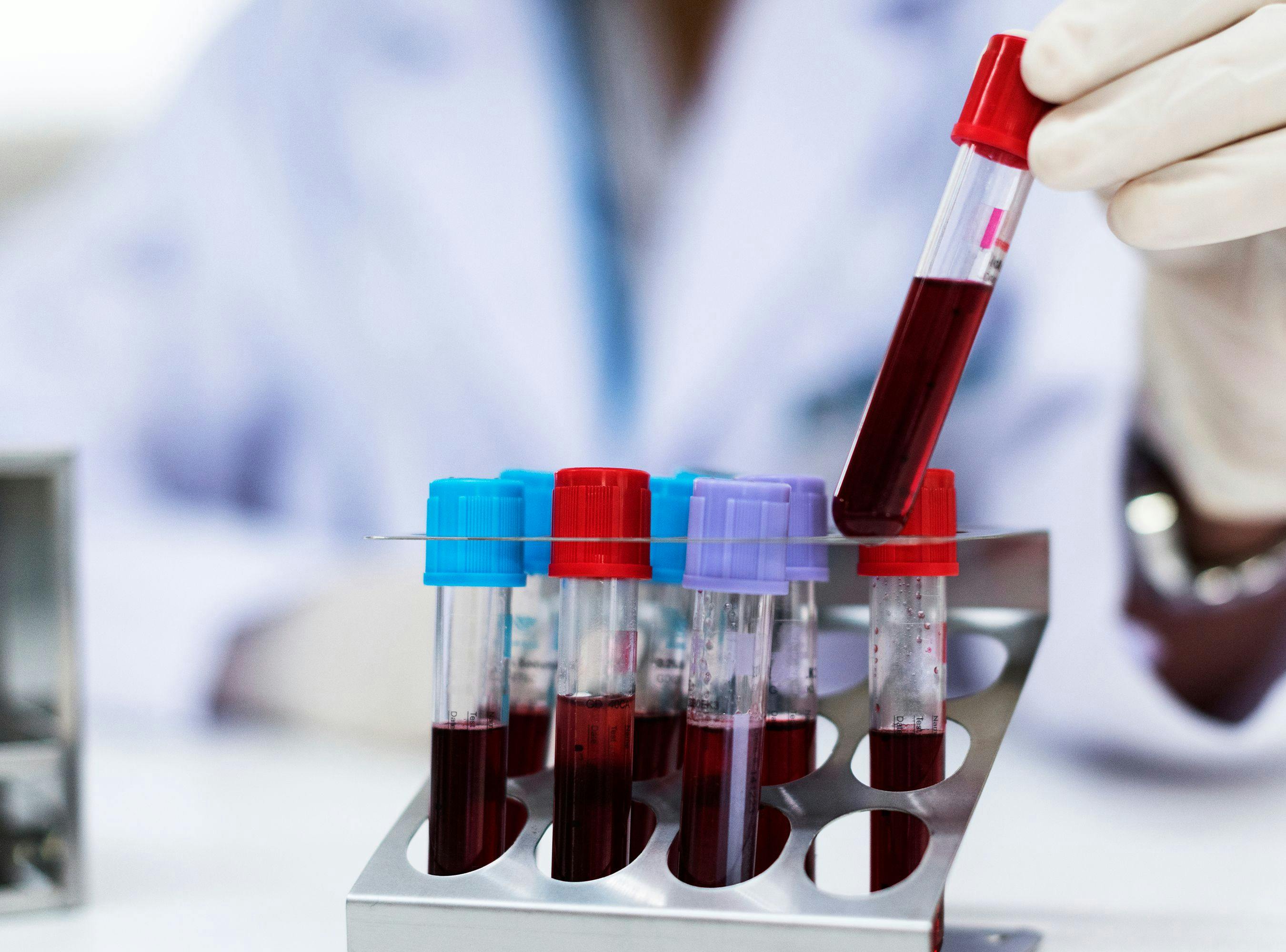 Experienced Pharmacology Expert Excluded For Failing to Determine Accuracy of Blood Test Results
