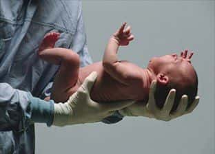 Obstetrician Expert Witness Discusses Respiratory Problems in Infant