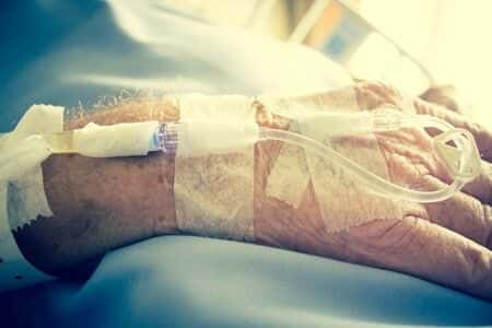 Delayed Treatment of Stroke Results in Untimely Death