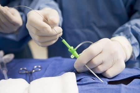 Improper Catheter Placement Causes Permanent Injuries