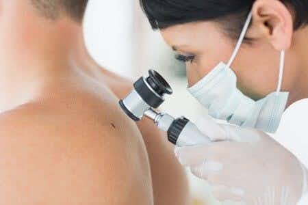 Fatal Error in Skin Cancer Diagnosis Linked to Physician Oversight