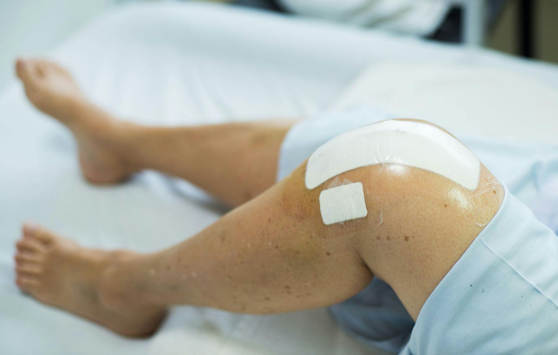 Knee replacement patient wearing bandage