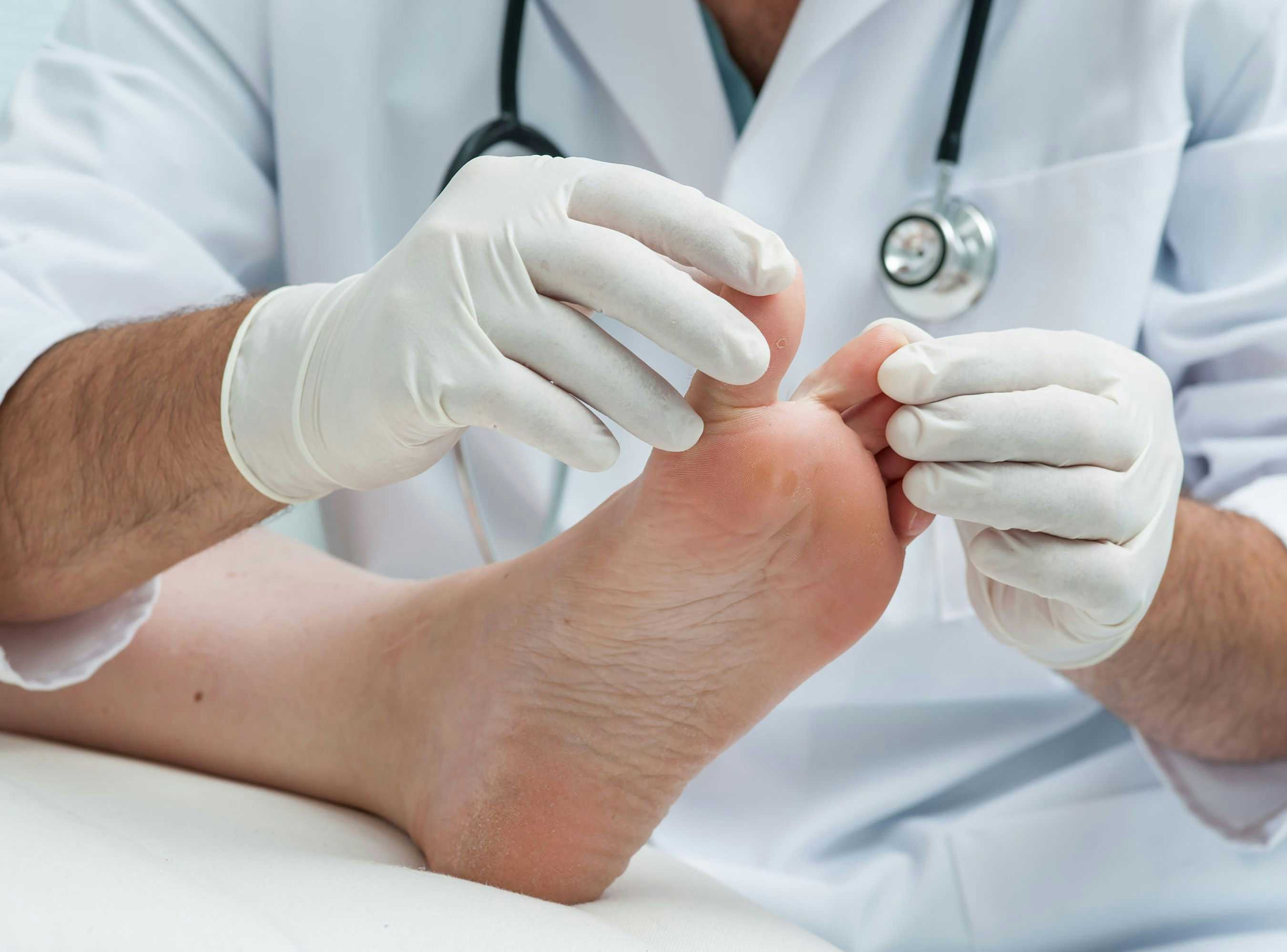 Podiatry Expert Assessment Excluded for Failing to Satisfy But-For Causation