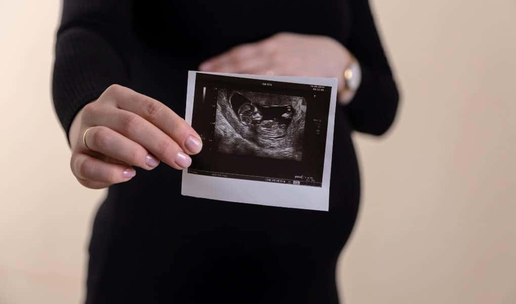 Laboratory Mistake Yields Inaccurate Report for Woman Pregnant With Down Syndrome Baby