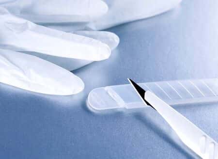 Kinked Ureter and Kidney Failure From Hysterectomy Procedure