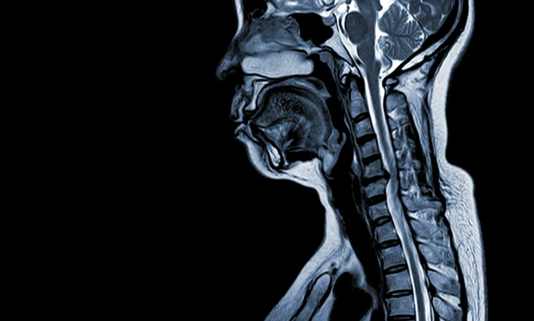 X-ray image of a persons neck