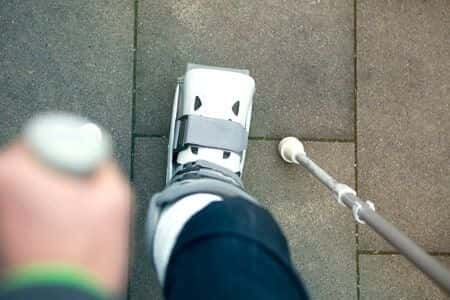 Knee Arthroplastry Results in Foot Drop Due to TED Stockings