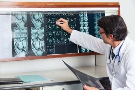 Radiology Technician’s Positioning of Patient Leads to Paralysis