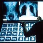 Radiologist Misses Fatal Hepatocellular Carcinoma