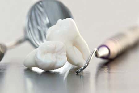 Infection Develops after Dentist Fails to Provide Antibiotics Following Tooth Extraction