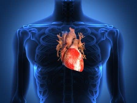 Cardiologist Fails to Order Life-Saving Catheterization