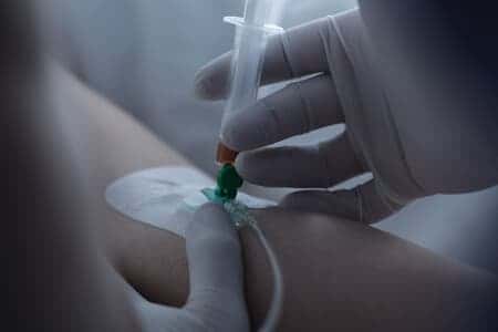 Improper Placement of IV Causes Fluid Leakage Under the Skin and Severe Skin Irritation