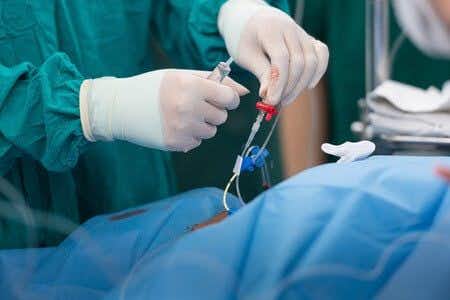 Femoral Artery Tear During Routine Catheterization Procedure
