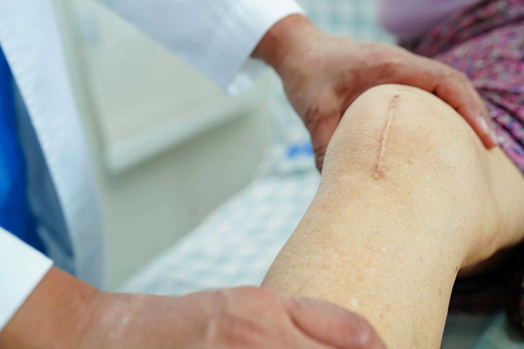 Doctor evaluating patient's knee with surgery scar