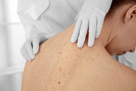 Delayed Skin Cancer Diagnosis Results In Complicated Removal