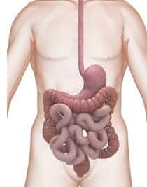 Gastroenterology Expert Witness Comments on Effects of Remicade