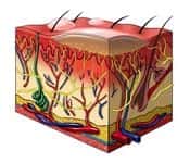 Patient Develops Stevens-Johnson Syndrome After Being Prescribed Dilantin