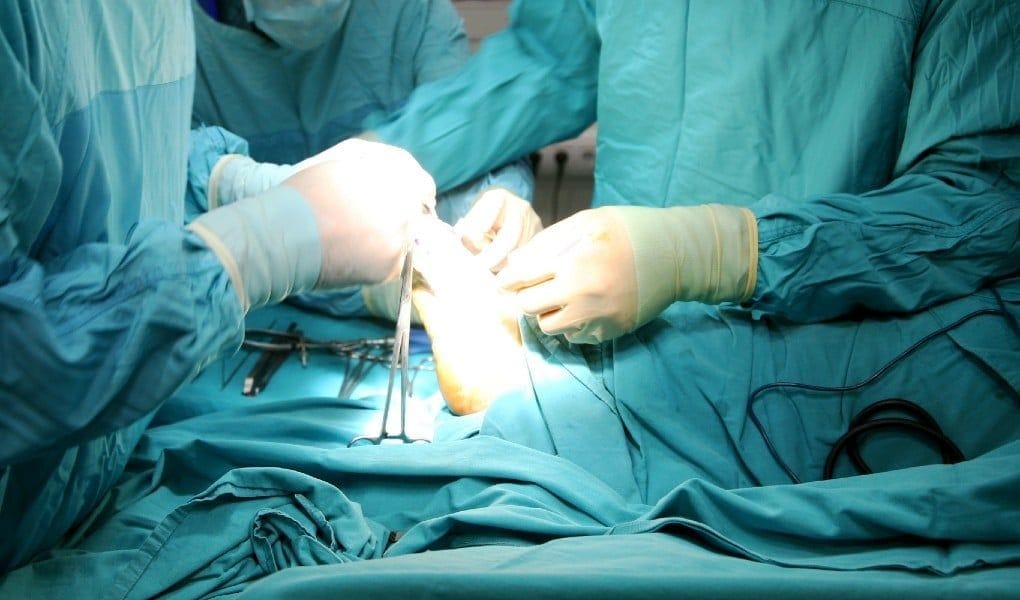 foot surgery