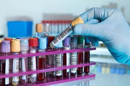 Rheumatology Expert Witness Discusses Bladder Cancer Diagnosis