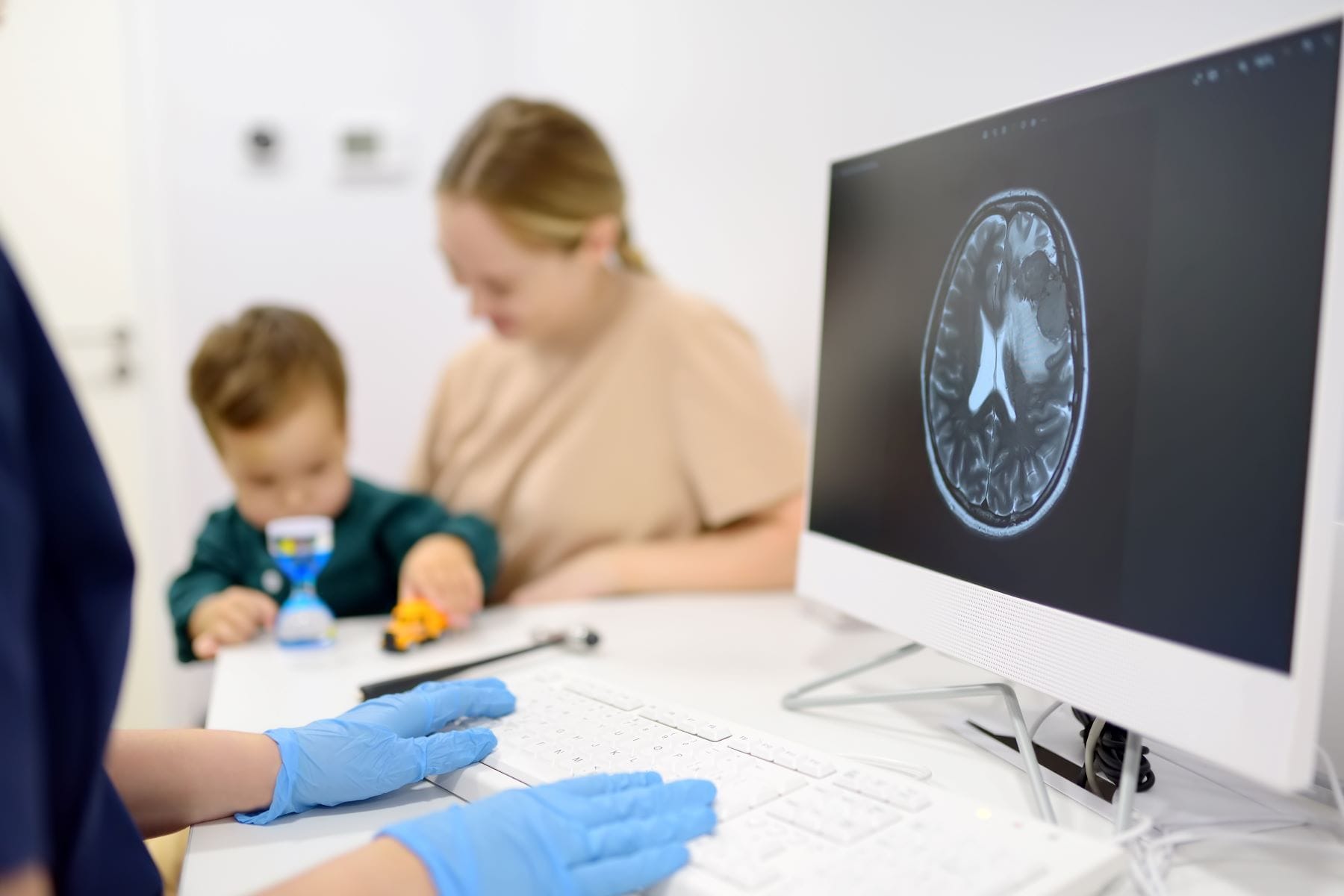 Doctor reviewing toddler's brain scan