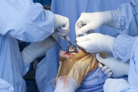 Poor intraoperative positioning during knee surgery results in permanent nerve damage