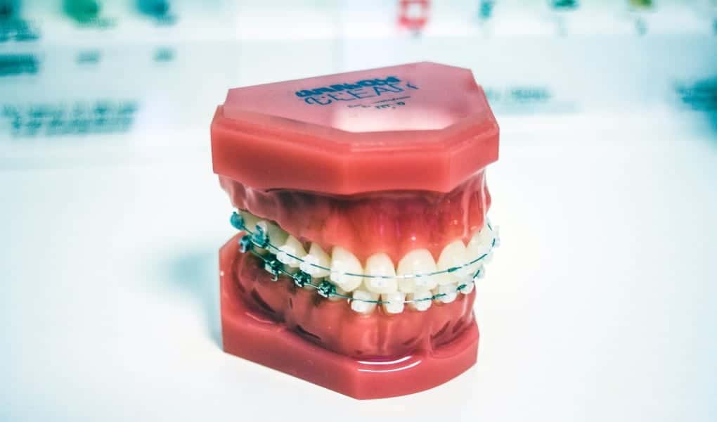 Dentistry Expert Witness’s Opinion Admissibility Depends on Reliance on Other Expert’s Opinion