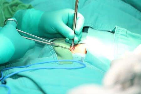 Surgical Implant Causes Allergic Reaction