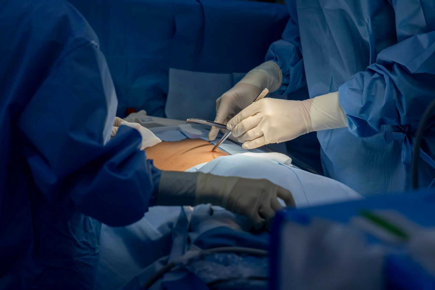 Spinal surgery procedure