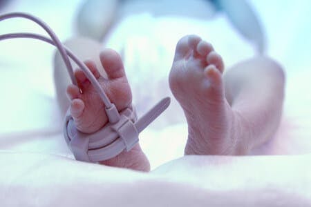 Botched Circumcision of a Newborn Male Patient Results in Permanent Lifelong Deformity