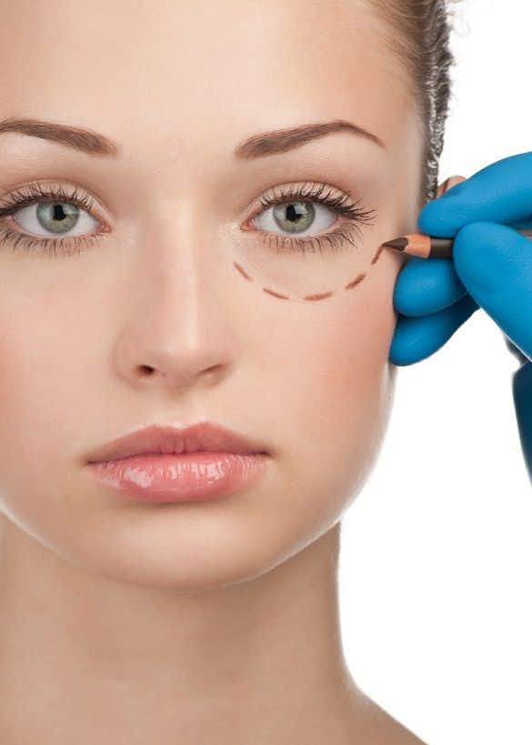 Plastic Surgery Expert Opines on Botched Face lift