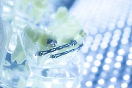 Orthodontic Patient Loses Teeth Due To Misread X-Rays