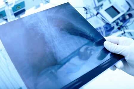 Surgeon Sued Over an Adrenalectomy Marred by Renal Failure