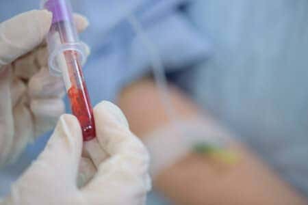 PSA Testing Expert Discusses Prostate Cancer Protocol