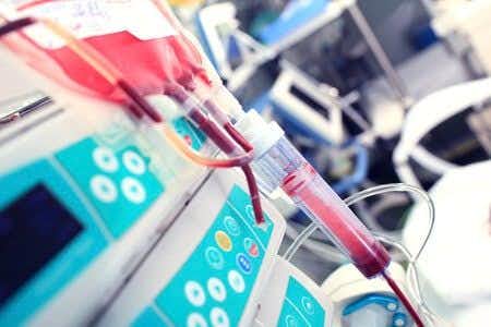 Doctors Fail to Diagnose Aneurysm in Peritoneal Dialysis Patient