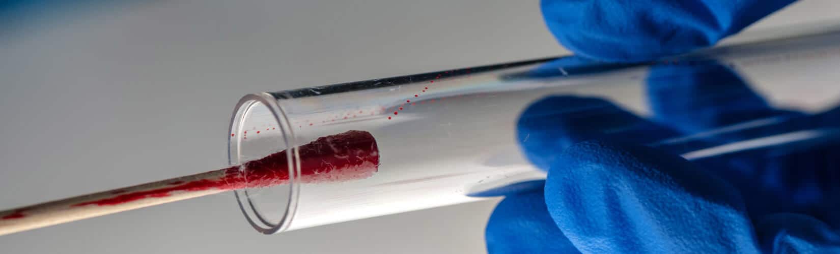 The Staircase: Netflix Documentary Calls Unreliable Forensic Science Into Question