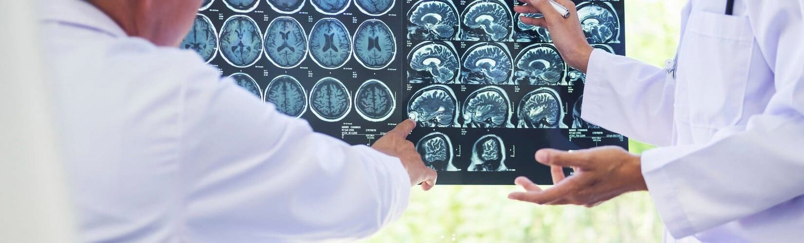 An Attorney’s Guide To Finding, Retaining & Consulting Neurosurgery Expert Witnesses