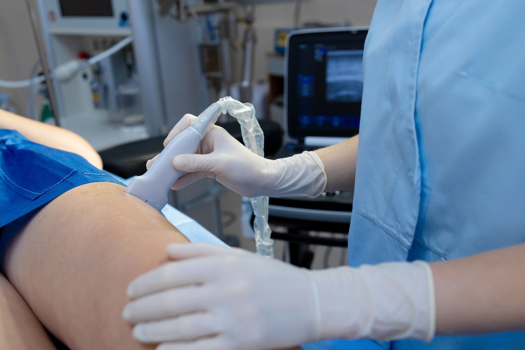 Vascular evaluation