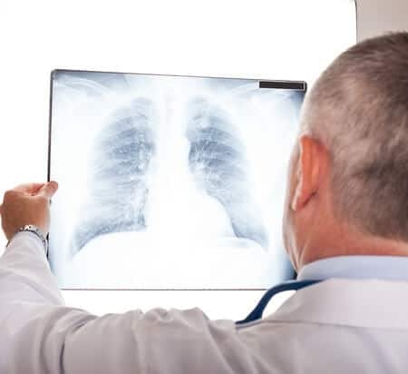 Rare Complication of Lung Biopsy Results in Patient&#8217;s Death