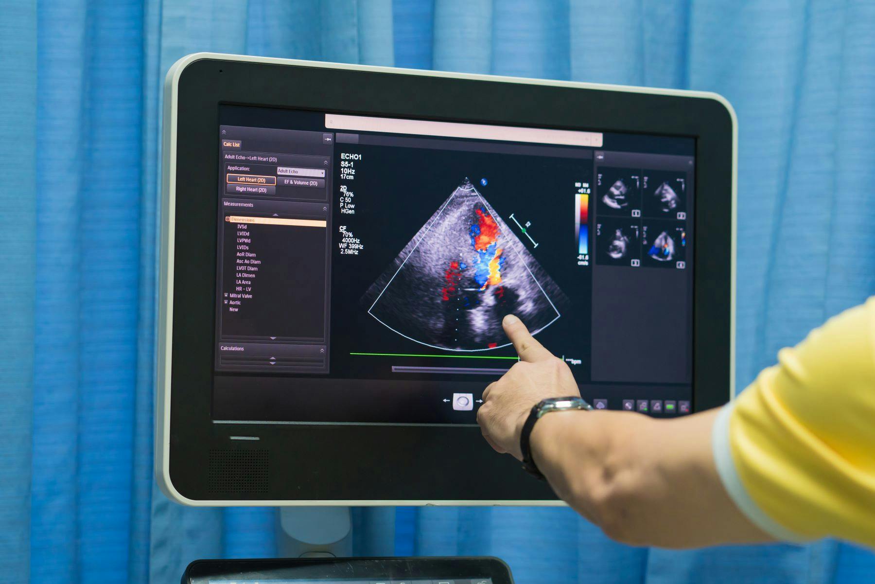 Doctor pointing at ultrasound scan