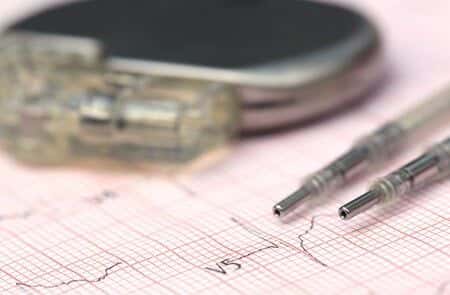 Patient Dies After Being Sent Home With Dysfunctional Pacemaker