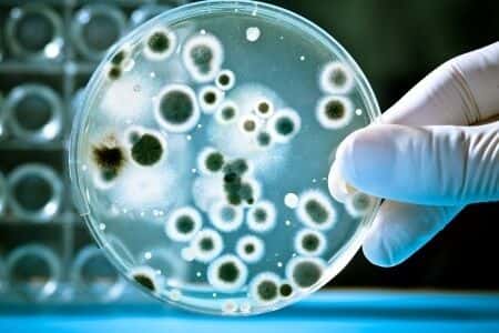 Bacterial Infection Leads to Amputation