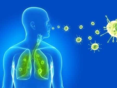 Delayed Diagnosis of Pneumonia Leads to Pulmonary Edema and Cardiac Arrest