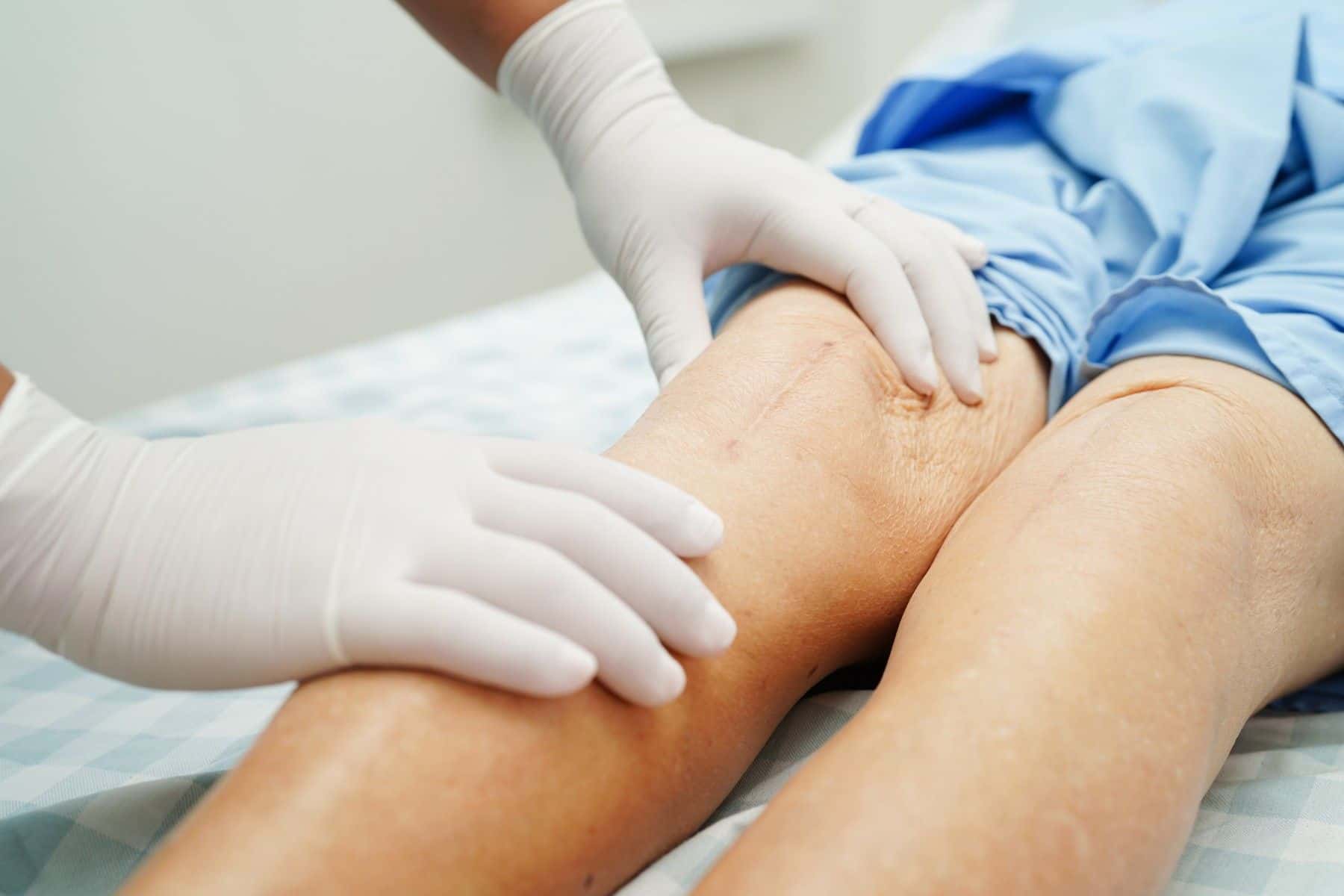 Knee replacement